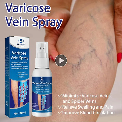Varicose Veins Treatments Ointment Spray Relief Veins Pain Vasculitis Phlebitis